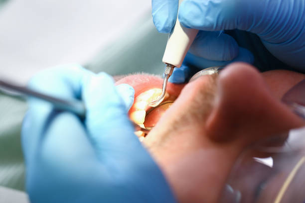 Best Emergency Gum Treatment in Walce, LA